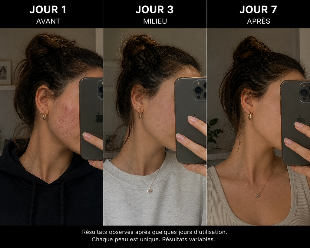 Sérum anti-imperfections